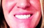 A very happy client with her lovely whitened teeth.