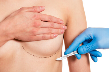 breast reconstruction