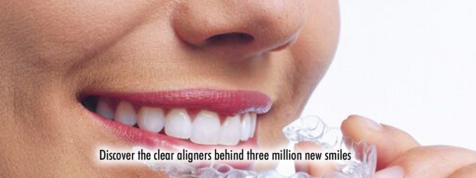 How long does Invisalign take to straighten teeth? - Finsbury Dental Care