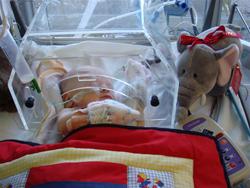 Baby having treatment in Southampton PICU