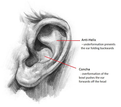 Pinnaplasty Ear Hampshire