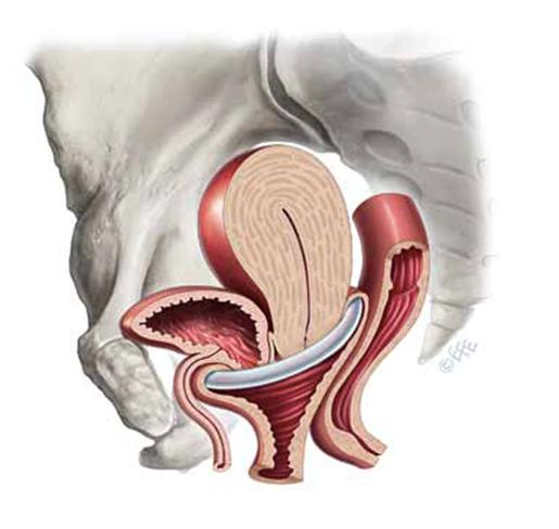 Common Conditions : Urogynaecologist & Gynaecologist in Essex