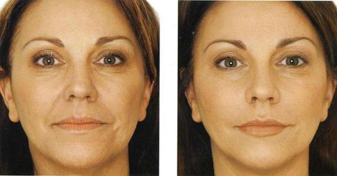 Cosmetic Dentistry in Acton