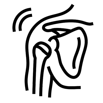 Shoulder impingement