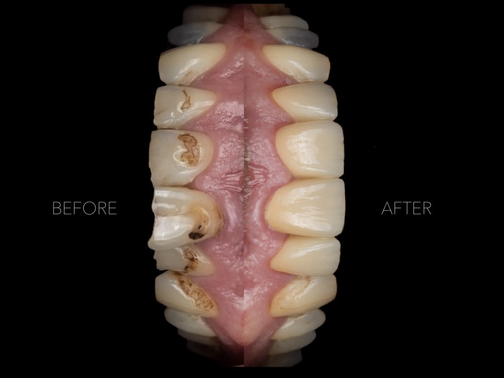 before after2