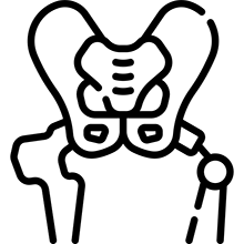 hip conditions
