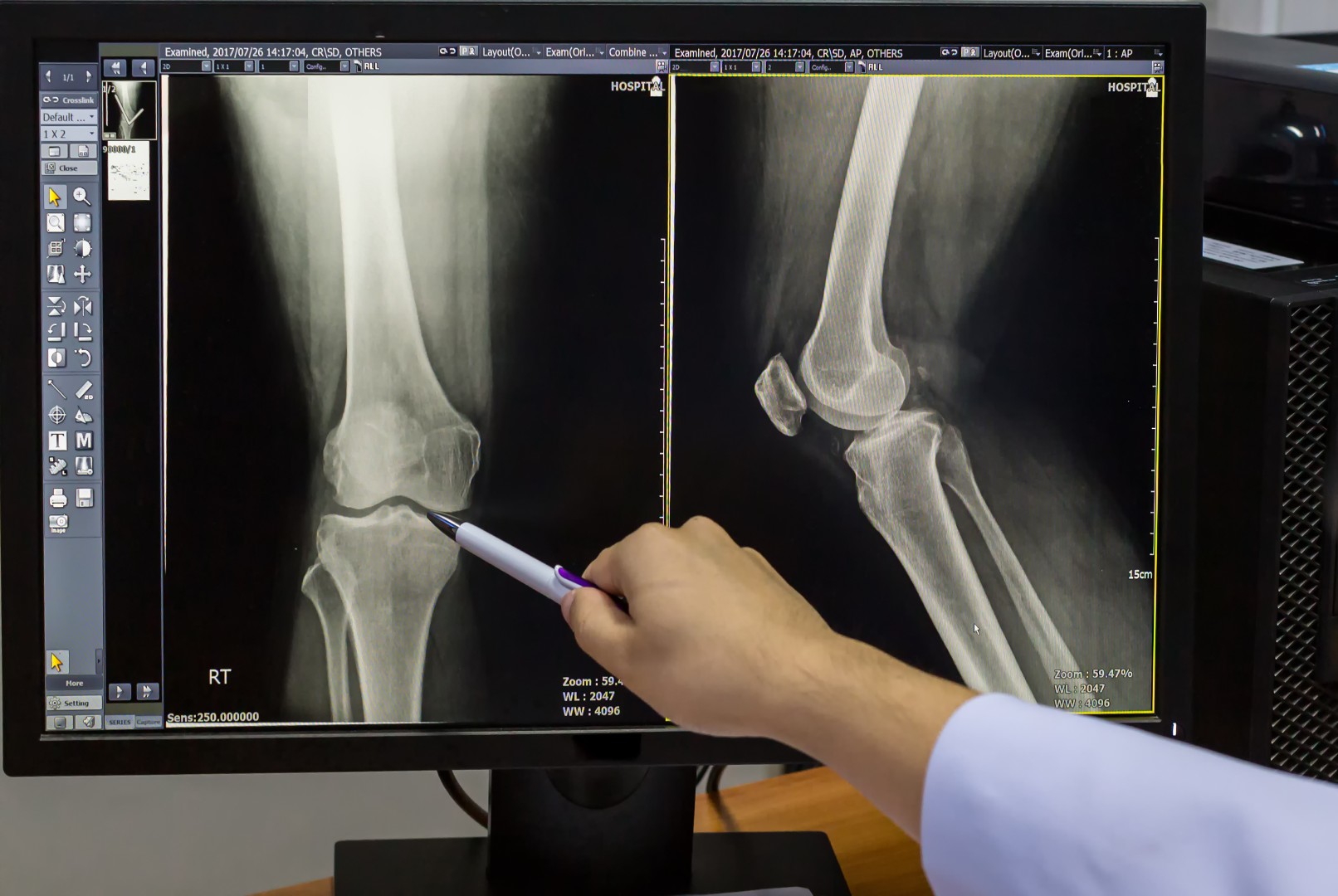 doctor pointing on the knee problem