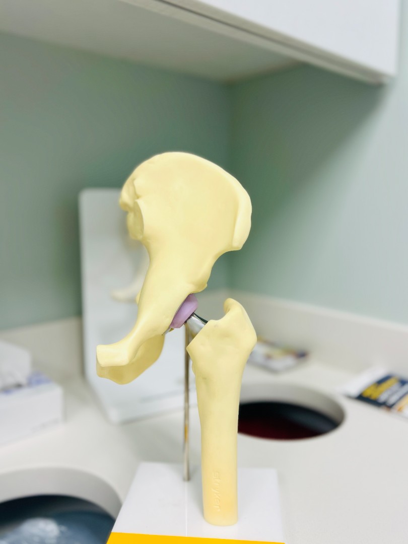 hip implant model