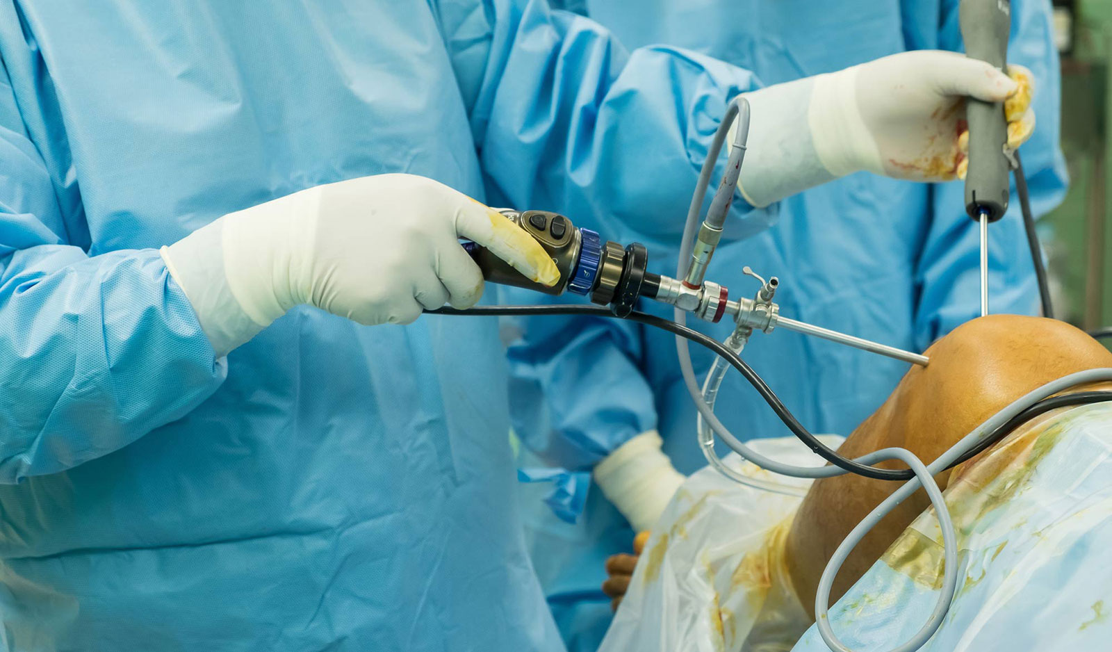 surgery