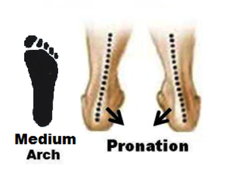 Pronated feet diagram